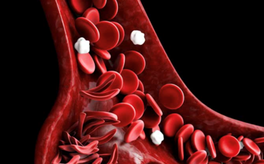 Photo showing red blood cells and sickle cells